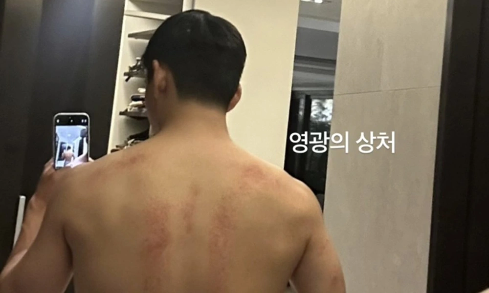 V drops bareback photos, shows off ‘wound of glory’